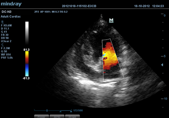 Cardiac Color Flow-Big Dog