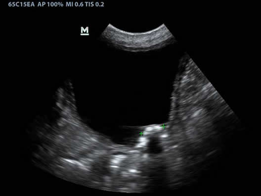 Canine Bladder