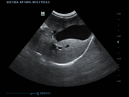 Canine Gallbladder