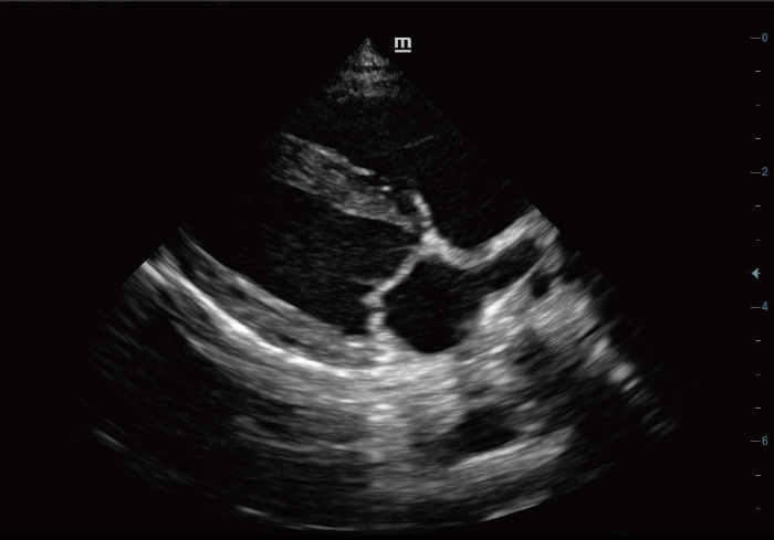 Long Axis View of Canine Heart