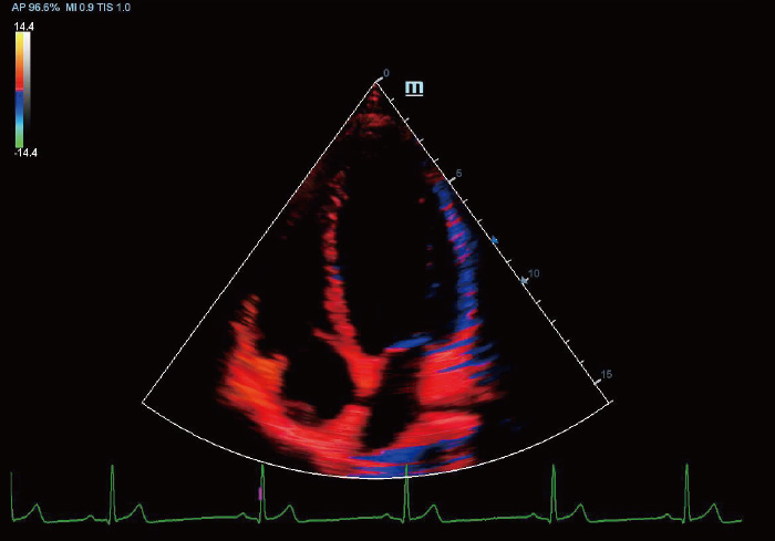 TDI of Canine Heart