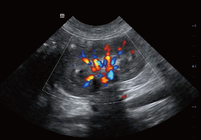 Color Mode of Canine Kidney