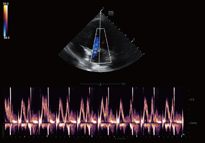 PW Mode of Canine Heart