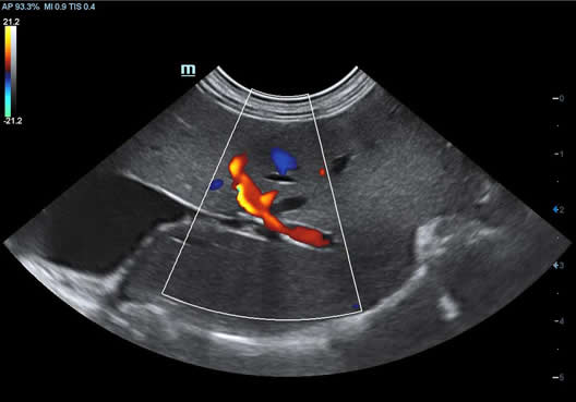 Hepatic Flow Feline