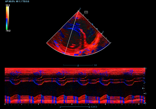 TVM of Canine Heart